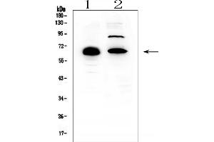 Western blot analysis of CCDC36 using anti-CCDC36 antibody (ABIN6719645). (CCDC36 抗体  (AA 172-472))