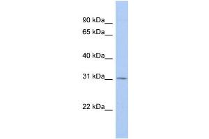 WB Suggested Anti-TSPAN12 Antibody Titration:  0. (TSPAN12 抗体  (Middle Region))