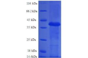 SDS-PAGE (SDS) image for Ribosomal Protein L36a-Like (RPL36AL) (AA 1-106), (full length) protein (GST tag) (ABIN7479223)