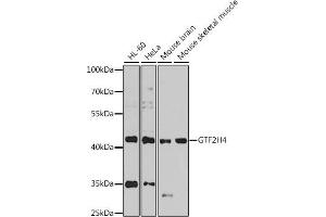 Western blot analysis of extracts of various cell lines, using GTF2H4 antibody  at 1:1000 dilution. (GTF2H4 抗体  (AA 1-300))