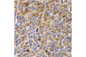 Immunohistochemistry of paraffin-embedded mouse cancer using UBE2R2 antibody at dilution of 1:100 (x400 lens). (UBE2R2 抗体)