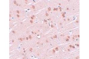 Immunohistochemistry (IHC) image for anti-Synaptogyrin 1 (SYNGR1) (Middle Region) antibody (ABIN1031113) (Synaptogyrin 1 抗体  (Middle Region))