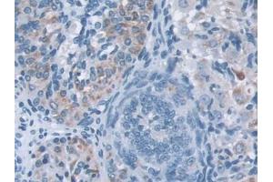 DAB staining on IHC-P; Samples: Mouse Ovary Tissue (IQGAP1 抗体  (AA 1276-1657))