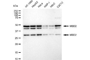 Western blotting analysis using MBD2 antibody (ABIN7799386). (Recombinant MBD2 抗体)