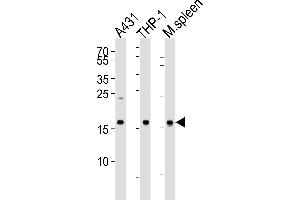 Western blot analysis of lysates from A431, THP-1 cell line and mouse spleen tissue lysate (from left to right), using SNX3 Antibody at 1:1000 at each lane. (Sorting Nexin 3 抗体  (AA 78-105))