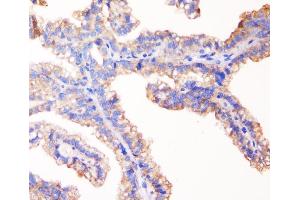 IHC analysis of TJP1 using anti-TJP1 antibody (ABIN7599787). (TJP1 抗体  (AA 1178-1527))