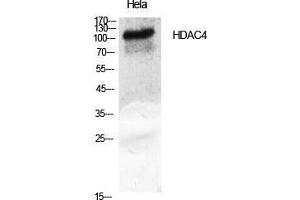 Western Blot (WB) analysis of specific cells using HDAC4 Polyclonal Antibody.