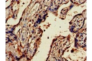 Immunohistochemistry of paraffin-embedded human placenta tissue using ABIN7174495 at dilution of 1:100 (UBE2V2 抗体  (AA 2-145))