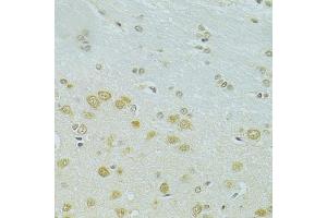 Immunohistochemistry of paraffin-embedded rat brain using RSRC1 antibody (ABIN5974341) at dilution of 1/100 (40x lens). (RSRC1 抗体)