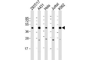PHF6 抗体  (AA 315-349)