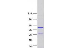Western Blotting (WB) image for Synaptonemal Complex Central Element Protein 1-Like (SYCE1L) protein (Myc-DYKDDDDK Tag) (ABIN2723171)