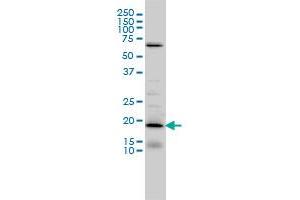D4S234E monoclonal antibody (M01), clone 1C3 Western Blot analysis of D4S234E expression in IMR-32 . (NSG1 抗体  (AA 1-185))