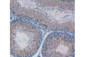 Immunohistochemistry (IHC) image for anti-Tumor Necrosis Factor Receptor Superfamily, Member 1B (TNFRSF1B) (AA 25-229) antibody (ABIN1871703)