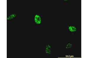 Immunofluorescence of monoclonal antibody to NKX2-5 on HeLa cell. (NK2 Homeobox 5 抗体  (AA 1-130))