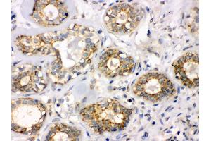 Immunohistochemistry (IHC) image for anti-UDP-GlcNAc:betaGal beta-1,3-N-Acetylglucosaminyltransferase 8 (B3GNT8) (AA 360-397), (C-Term) antibody (ABIN3043797)