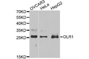 Western blot analysis of extracts of various cell lines, using OLR1 antibody (ABIN5970808) at 1/1000 dilution. (OLR1 抗体)