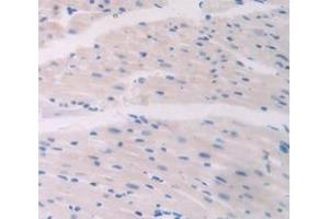 Immunohistochemistry (IHC) image for anti-Collagen, Type VI, alpha 1 (COL6A1) (AA 624-800) antibody (ABIN1858462)