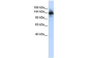 WB Suggested Anti-RBM6 Antibody Titration: 0. (RBM6 抗体  (N-Term))