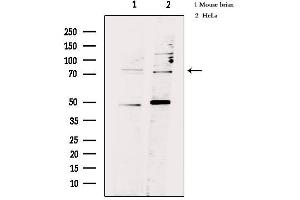 Western blot analysis of extracts from various samples, using FSHR Antibody. (FSHR 抗体  (Internal Region))