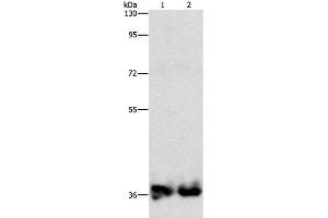 Western Blot analysis of Mouse kidney and Human fetal kidney tissue using ASPA Polyclonal Antibody at dilution of 1:1400 (ASPA 抗体)