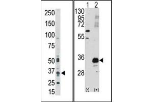 Image no. 1 for anti-Pim-1 Oncogene (PIM1) (C-Term) antibody (ABIN360327) (PIM1 抗体  (C-Term))