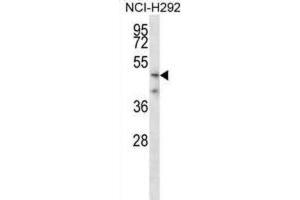 Western Blotting (WB) image for anti-Transmembrane Protease, serine 5 (TMPRSS5) antibody (ABIN2998262) (TMPRSS5 抗体)