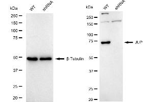 Western blotting analysis using JUP antibody (ABIN7799151). (Recombinant JUP 抗体)