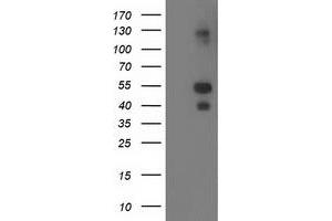 Western Blotting (WB) image for anti-LIM and Cysteine-Rich Domains 1 (LMCD1) antibody (ABIN1499184) (LMCD1 抗体)