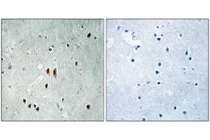 Immunohistochemical analysis of paraffin-embedded human brain tissue using CNOT2 (Phospho-Ser101) antibody (left)or the same antibody preincubated with blocking peptide (right). (CNOT2 抗体  (pSer101))