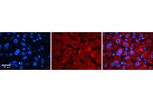 Immunohistochemistry (IHC) image for anti-Transcription Factor B1, Mitochondrial (TFB1M) (N-Term) antibody (ABIN2775859)