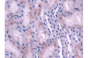 DAB staining on IHC-P; Samples: Rat Kidney Tissue (NDRG2 抗体  (AA 2-300))
