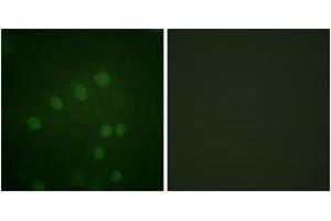 Immunofluorescence analysis of HepG2 cells, using AurB (Phospho-Thr232) Antibody. (Aurora Kinase B 抗体  (pThr232))