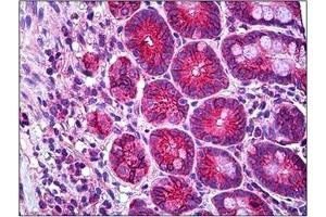 Human Small Intestine: Formalin-Fixed, Paraffin-Embedded (FFPE) (RHOH 抗体  (C-Term))