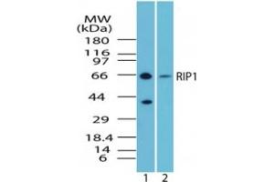 Image no. 1 for anti-Receptor (TNFRSF)-Interacting serine-threonine Kinase 1 (RIPK1) (AA 350-400) antibody (ABIN207743) (RIPK1 抗体  (AA 350-400))