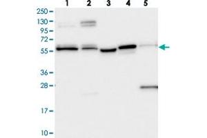 Western blot analysis of Lane 1: RT-4, Lane 2: U-251 MG, Lane 3: Human Plasma, Lane 4: Liver, Lane 5: Tonsil with PPRC1 polyclonal antibody  at 1:250-1:500 dilution. (PPRC1 抗体)