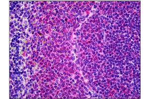 Immunohistochemistry (IHC) image for anti-Interleukin 6 (IL6) antibody (ABIN781989) (IL-6 抗体)