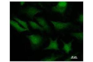 Immunofluorescence (IF) image for anti-Signal Transducer and Activator of Transcription 3 (Acute-Phase Response Factor) (STAT3) antibody (ABIN933094)