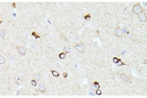 Immunohistochemistry of paraffin-embedded Rat brain using CCDC6 Polyclonal Antibody at dilution of 1:100 (40x lens). (CCDC6 抗体)