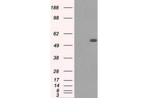 HEK293T cells were transfected with the pCMV6-ENTRY control (Left lane) or pCMV6-ENTRY FH (Right lane) cDNA for 48 hrs and lysed. (FH 抗体)