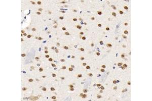 Immunohistochemistry of paraffin embedded mouse brain using TCEAL3 (ABIN7075951) at dilution of 1:700 (400x lens)