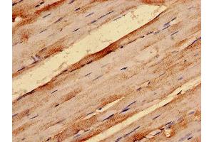 IHC analysis of paraffin-embedded human skeletal muscle tissue, using G0S2 antibody (1/100 dilution). (G0S2 抗体  (AA 1-103))