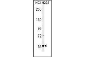 Western blot analysis of RAD26L Antibody (Center) in NCI-H292 cell line lysates (35ug/lane). (ERCC6L2 抗体  (Middle Region))