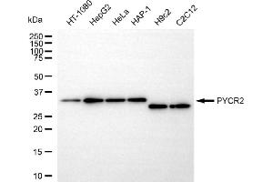 Western blotting analysis using PYCR2 antibody (ABIN7800079). (PYCR2 抗体)
