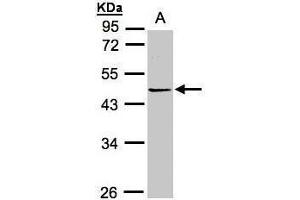 WB Image Sample(30 ug whole cell lysate) A:Hep G2 , 10% SDS PAGE antibody diluted at 1:1000 (PRMT2 抗体)