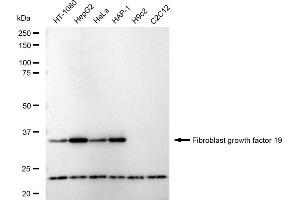 Western blotting analysis using Fibroblast growth factor 19 antibody (ABIN7798603).