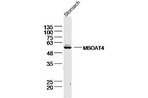 Lane 1: Mouse stomach lysates probed with Ghrelin O acyltransferase Antibody, Unconjugated (bs-13355R) at 1:300 overnight at 4˚C. (MBOAT4 抗体  (AA 101-200))