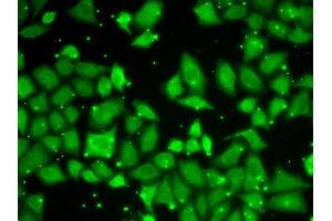 Immunofluorescence analysis of U2OS cells using MLST8 antibody (ABIN6131371, ABIN6143894, ABIN6143895 and ABIN6217660). (GBL 抗体  (AA 1-326))