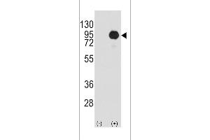 Western blot analysis of BRAF (arrow) using rabbit polyclonal BRAF Antibody  (R).