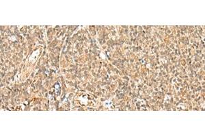 Immunohistochemistry of paraffin-embedded Human tonsil tissue using GTF2A2 Polyclonal Antibody at dilution of 1:30(x200) (GTF2A2 抗体)