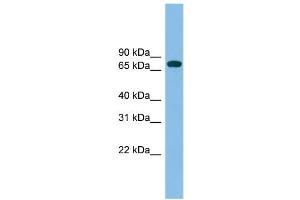 WB Suggested Anti-GBP2 Antibody Titration: 0. (GBP2 抗体  (N-Term))